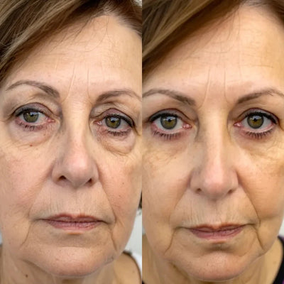 Cemenrete Calcium Dark Spot Eye Cream