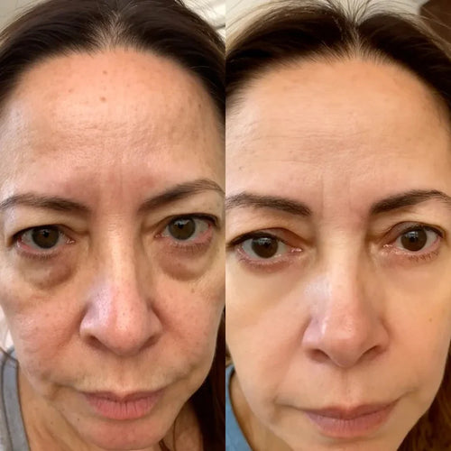 Cemenrete Calcium Dark Spot Eye Cream