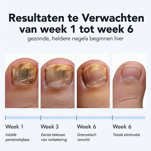 Hexro Schimmelnagel Herstelpleisters