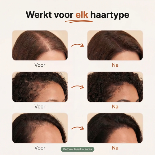 Koreaanse Haargroeiserum voor Dun Haar & Haaruitval