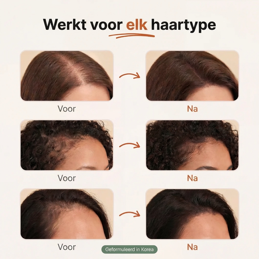 Koreaanse Haargroeiserum voor Dun Haar & Haaruitval
