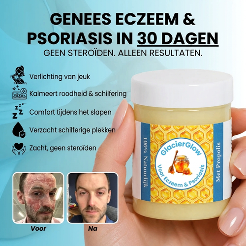GlacierSkin – Herstelbalsem voor Eczeem & Psoriasis