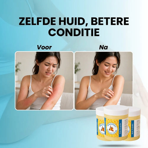 GlacierSkin – Herstelbalsem voor Eczeem & Psoriasis